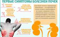 Как болит застуженная почка
